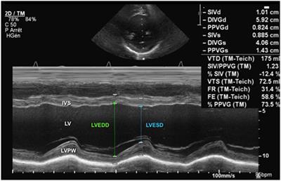 Frontiers | Echocardiographic Evaluation of Ventricular Function—For the Neonatologist and ...