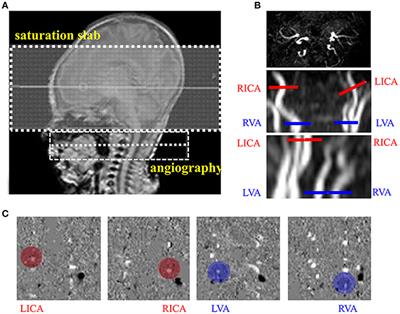 Frontiers  Hemodynamic and Metabolic Assessment of Neonates With