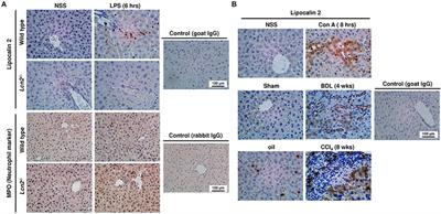 Frontiers N Glycosylation Of Lipocalin 2 Is Not Required For Frontiers N Glycosylation Of Lipocalin 2 Is Not Required For Secretion Or Exosome Targeting Pharmacology