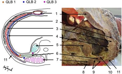 quadratus lumborum