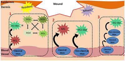 Frontiers  Exploring the contribution of pro-inflammatory cytokines to  impaired wound healing in diabetes