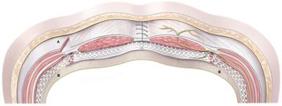 Frontiers | What Do We Know About Component Separation Techniques for ...