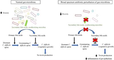Dysbiosis probiotics - Dysbiosis and depression, Dysbiosis examples