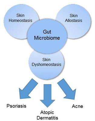 psoriasis and gut health