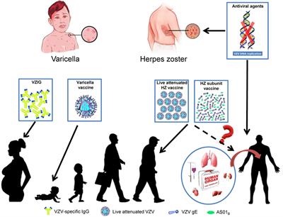 Frontiers Herpes Zoster And Immunogenicity And Safety Of Zoster