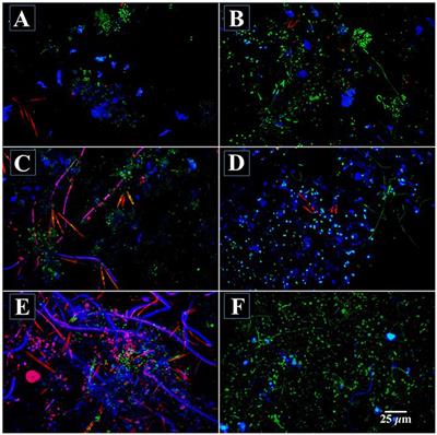 Frontiers | Multi-Parameter Laser Imaging Reveals Complex Microscale Biofilm Matrix in a Thick (4,000 μm) Aerobic Methanol Oxidizing Community Frontiers | Multi-Parameter Laser Imaging Reveals Complex Microscale Biofilm Matrix in a Thick (4,000 μm) Aerobic Methanol Oxidizing Community