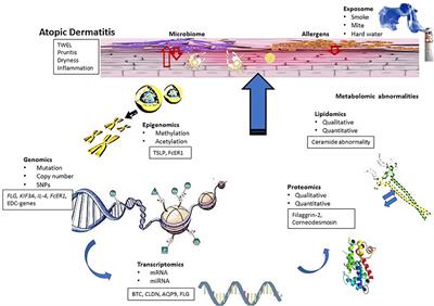 Atopic dermatitis pathogenesis