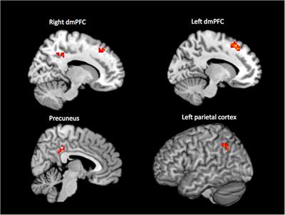 Brain scans are putting a major theory of consciousness to the test