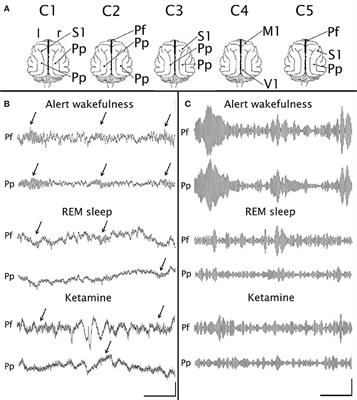 Frontiers Eeg 40 Hz Coherence Decreases In Rem Sleep And Ketamine Model Of Psychosis Psychiatry