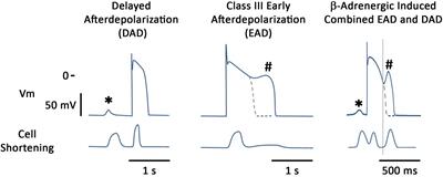 Frontiers Arrhythmogenic Mechanisms In Heart Failure Linking B Adrenergic Stimulation Stretch And Calcium Physiology