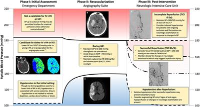 Should I be more careful about cerebrovascular disease in hypertension patients? 2