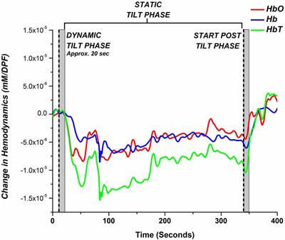 Tilt Table Test - Melbourne Heart Rhythm