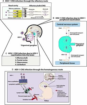 Frontiers   Herpes Simplex Virus Type 1 Infection of the Central