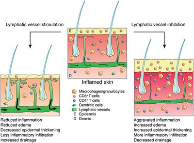 Frontiers | Inflammation and Lymphatic Function