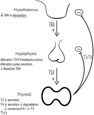 Tsh W Reflex To Ft4 Chart