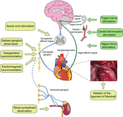 Frontiers | Autonomic Neuromodulation for Preventing and Treating ...