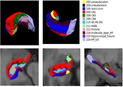 Trajectories of the Hippocampal Subfields Atrophy in the Alzheimer’s Disease: A Structural Imaging Study