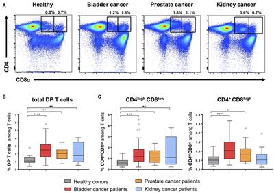 Double Positive CD4+CD8+ T Cells Are Enriched in Urological Cancers and Favor T Helper-2 Polarization