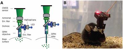 Using Baseplating and a Miniscope Preanchored with an Objective Lens for  Calcium Transient Research in Mice