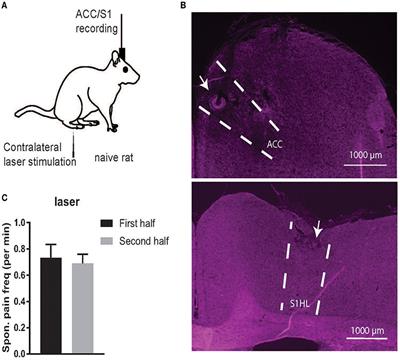 Frontiers  Cortical Pain Processing in the Rat Anterior Cingulate 