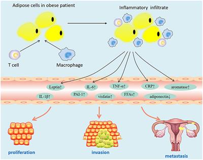 Endometrial cancer progression. ROMANIAN JOURNAL of MORPHOLOGY and EMBRYOLOGY