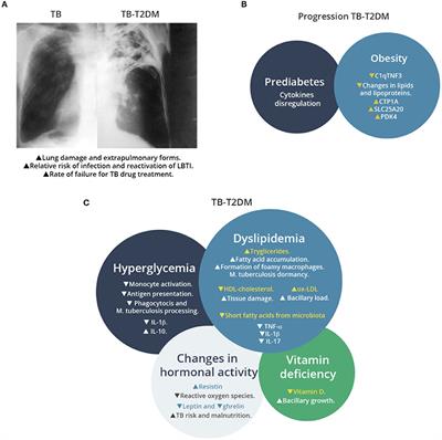 Frontiers Changes In Host Response To Mycobacterium Tuberculosis Infection Associated With Type 2 Diabetes Beyond Hyperglycemia Cellular And Infection Microbiology