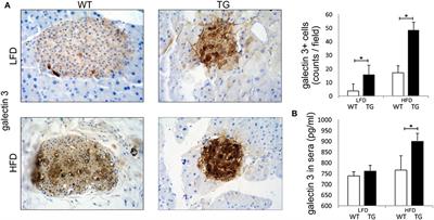 Frontiers Overexpression Of Galectin 3 In Pancreatic B Cells Amplifies B Cell Apoptosis And Islet Inflammation In Type 2 Diabetes In Mice Endocrinology