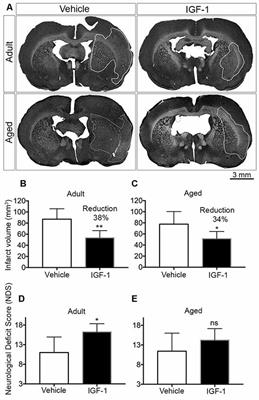 igf1 és anti aging