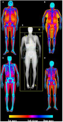 DEXA Scan Houston, DEXA Body fat scan in Houston TX