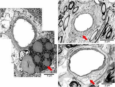 Frontiers Solving An Old Dogma Is It An Arteriole Or A Venule Frontiers In Aging Neuroscience Frontiers Solving An Old Dogma Is It An Arteriole Or A Venule Frontiers In Aging Neuroscience