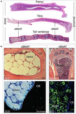 Frontiers Reporting Guidelines Review Of Methodological Standards And Challenges Toward Harmonization In Bone Marrow Adiposity Research Report Of The Methodologies Working Group Of The International Bone Marrow Adiposity Society Endocrinology