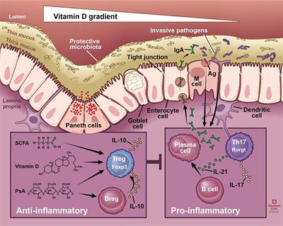 Vitamin D And Its Role in Inflammatory Bowel Disease (Ibd)