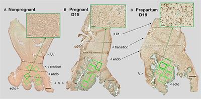 images Low Cervix In Early Pregnancy Forum immunobiology of cervix ripening