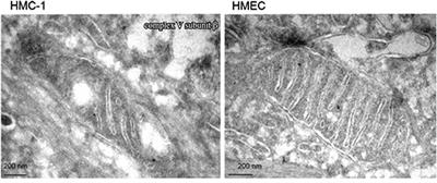 Frontiers | Consideration of Ketogenic Metabolic Therapy as a ...