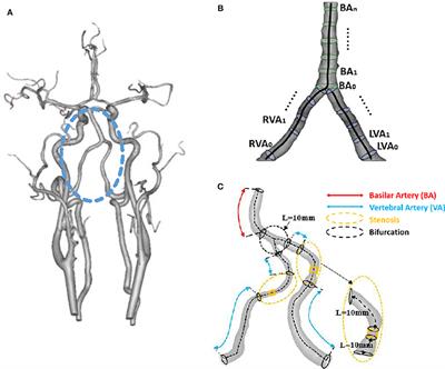 vertebral artery