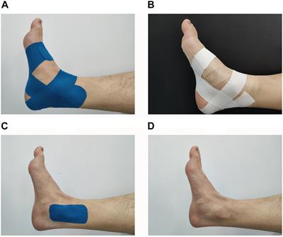 K-Taping in neurology as a therapy addition