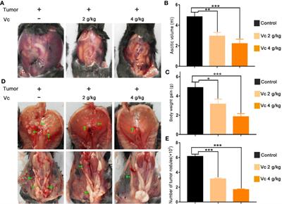 cancer in peritoneal wall