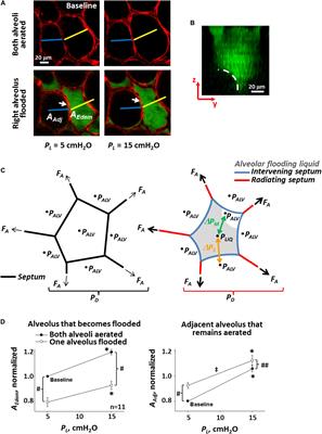 Frontiers The Contribution Of Surface Tension Dependent Alveolar Septal Stress Concentrations To Ventilation Induced Lung Injury In The Acute Respiratory Distress Syndrome Physiology