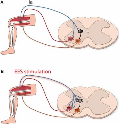 Electrical Stimulation - Muscle & Spine Rehabilitation Center