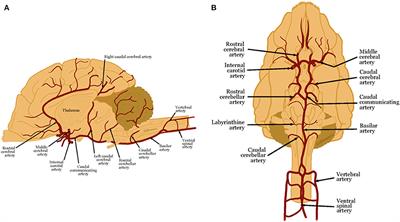 Venous vascular territories of the lateral cerebral cortex (illustration), Radiology Case