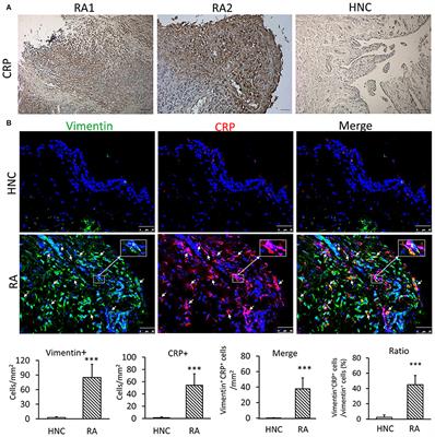 C-Reactive Protein Promotes the Activation of Fibroblast ... - Frontiers