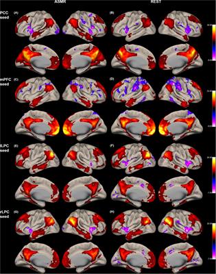 Frontiers Effects Of Autonomous Sensory Meridian Response On The Functional Connectivity As Measured By Functional Magnetic Resonance Imaging Behavioral Neuroscience
