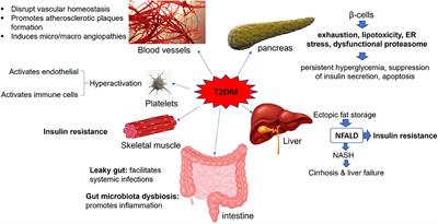 Frontiers | The Effects of Type 2 Diabetes Mellitus on Organ Metabolism and  the Immune System