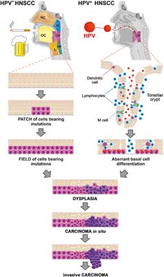 hpv tulehduksen tünet