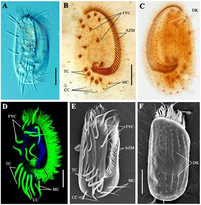Frontiers | Morpholino-Mediated Knockdown of Ciliary Genes in Euplotes  vannus, a Novel Marine Ciliated Model Organism