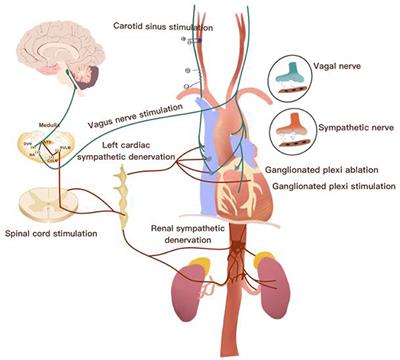 The vagus afferent network: emerging role in translational connectomics in:  Neurosurgical Focus Volume 45 Issue 3 (2018) Journals