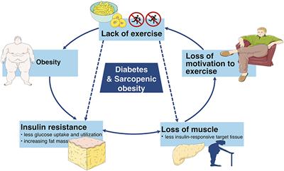 diabetes ncbi 2021