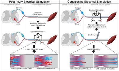 Frontiers  Neuromuscular or Sensory Electrical Stimulation for  Reconditioning Motor Output and Postural Balance in Older Subjects?