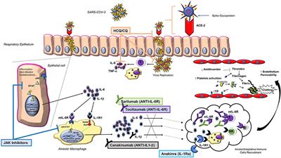 Experience With the Use of Baricitinib and Tocilizumab Monotherapy or  Combined, in Patients With Interstitial Pneumonia Secondary to Coronavirus  COVID19: A Real-World Study