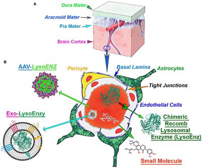 Morphology of Niemann-Pick type A metabolic storage disorder